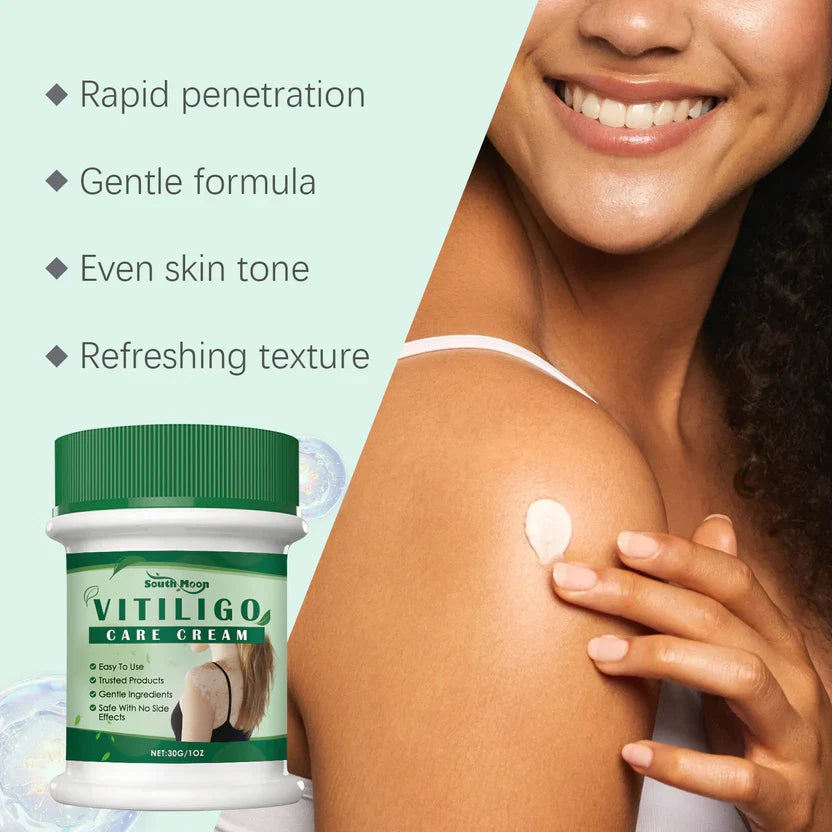 Vitiligo Care Cream