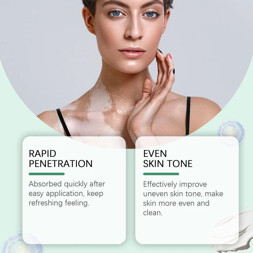 Vitiligo Care Cream