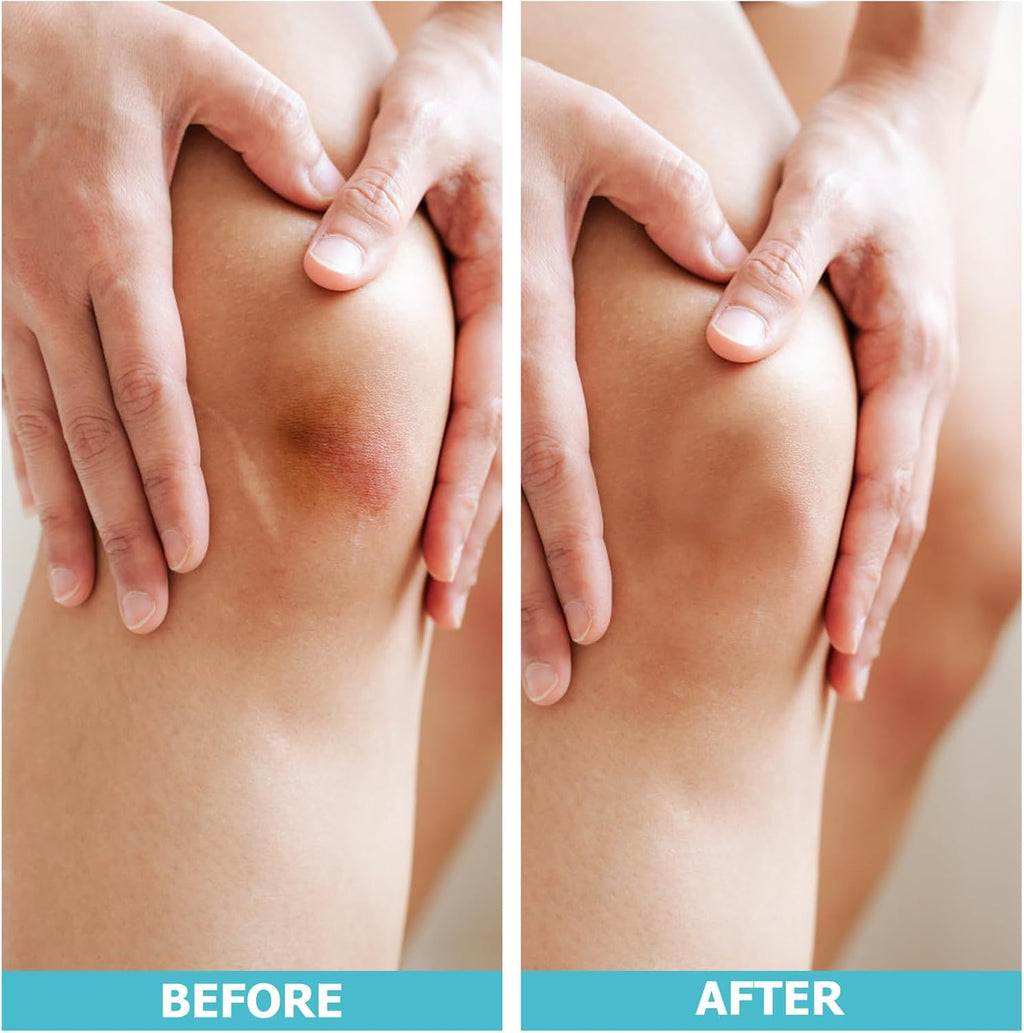 Hydrocolloid Roll for Wound Care