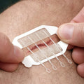 Everlit Wound Closure Kit – 2 Pcs, Suture-Free Strips