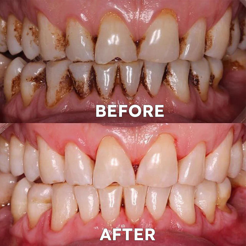 Ourlyard™ Tooth Powder